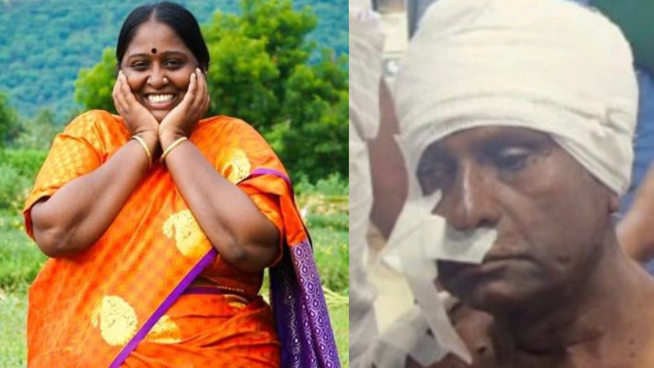 நடிகை தீபாவின் தந்தைக்கு அரிவாளால் வெட்டு!